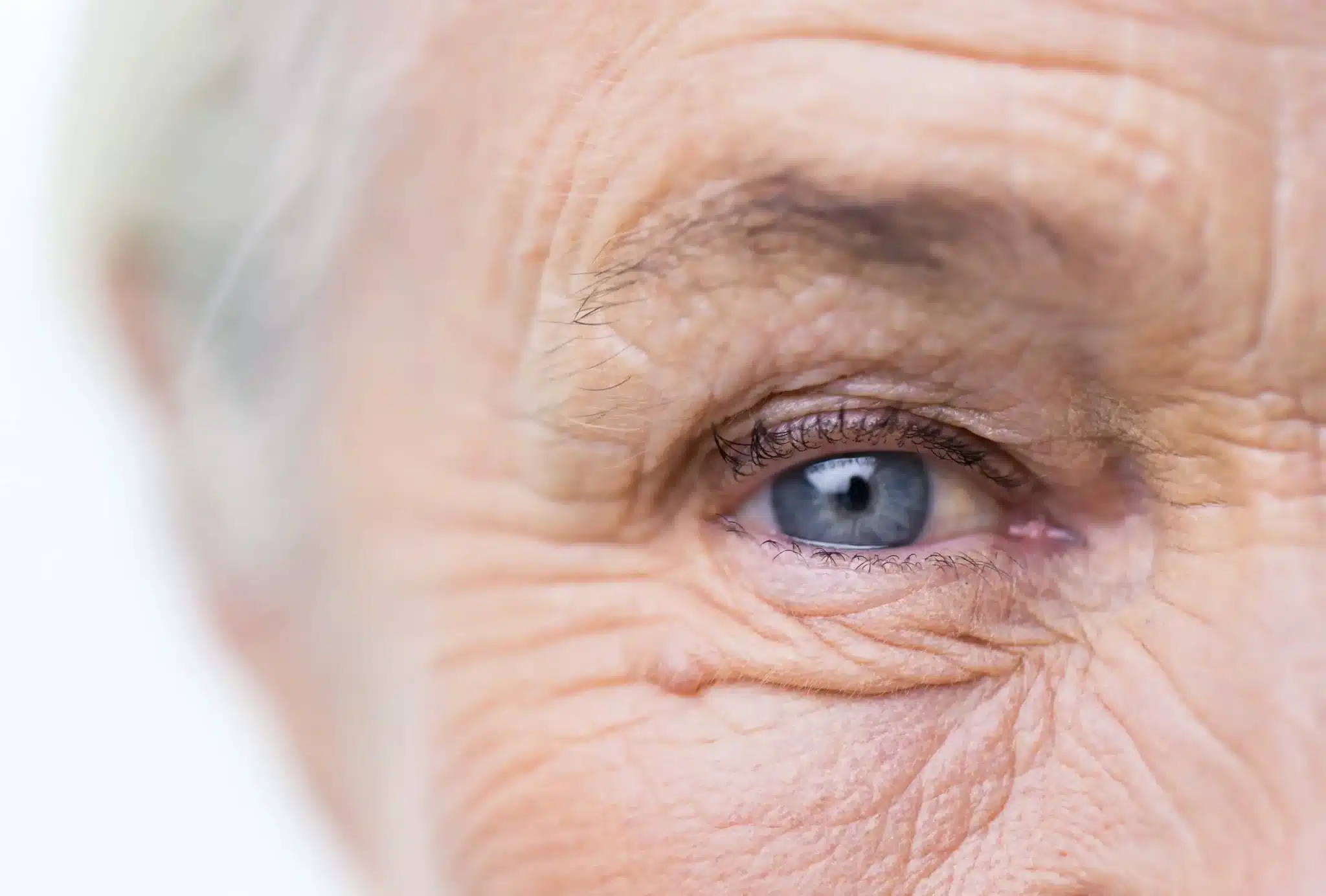 An elderly woman with blue eyes.